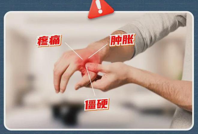 手酸、手麻、腱鞘问题推荐用它！必一体育网站小米生态杀疯了！