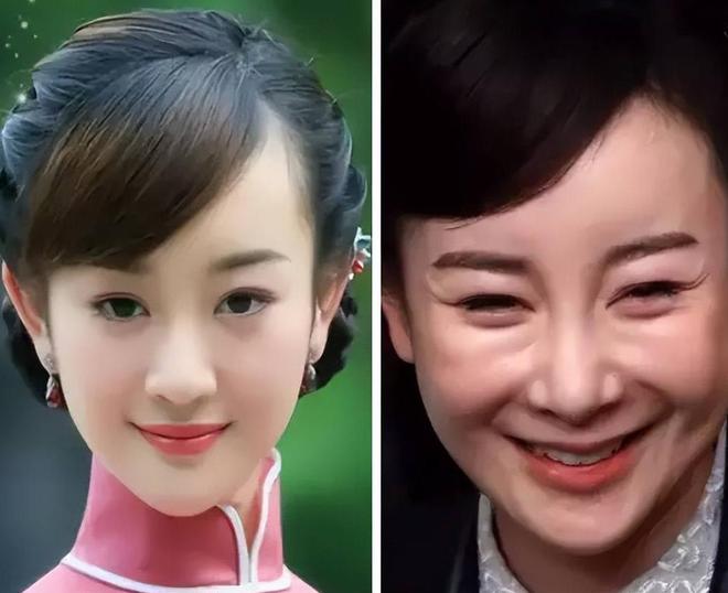 人长出老年斑有人家破人亡毁了脸必一运动6位过气明星现状：有(图6)